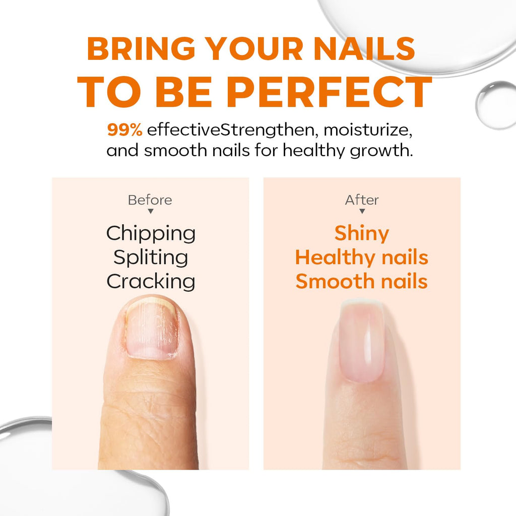 modelones Nail Strengthener and Growth. Clear Nail Polish Nail Repair for Damaged Nails Hardener Extra Strong and Growth Natural Nail Care Gifts for Women Toenails Concealer Polsih 15ml : Beauty & Personal Care