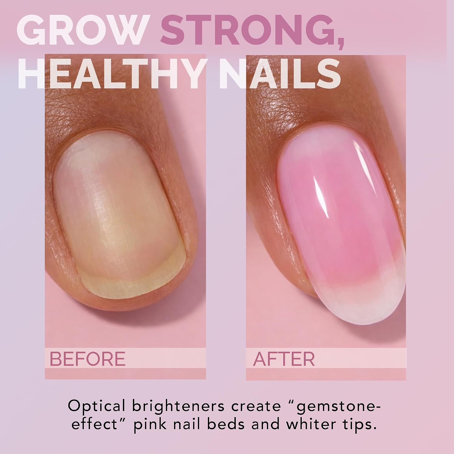 Perfect Formula Ruby Pink Gel Coat - Nail Strengthener. Keratin Nail Treatment. Gemstone Pink Gel Nail Polish - Nail Strengthener for Damaged Nails - Made In The USA .60 fl oz. : Beauty & Personal Care