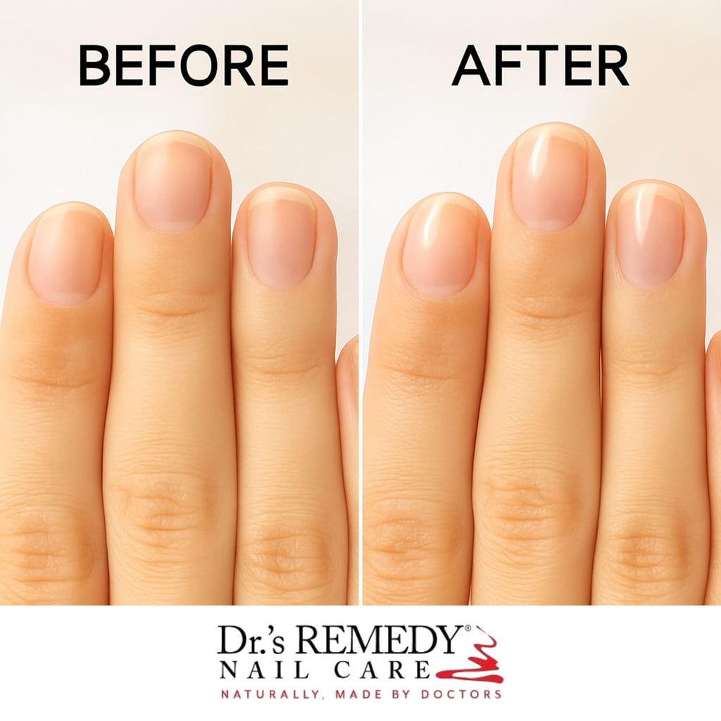Dr.'s Remedy Total Two-In-One Base And Top Coat Nail Polish Clear Glaze Organic Nail Polishes Quick Dry. Clear Combination Base & Top Coats. 0.5 Fl Oz : Beauty & Personal Care